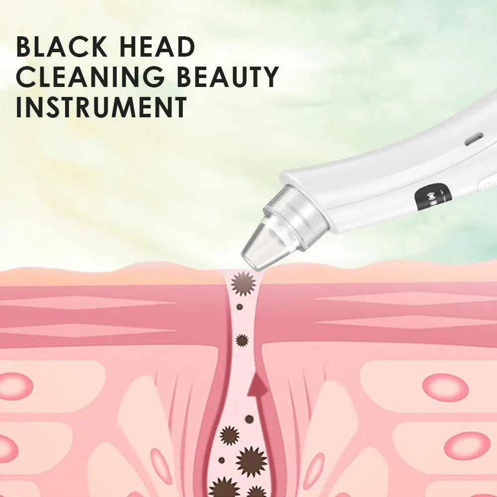 3 Suction Mode Face Vacuum Blackhead Removal Device